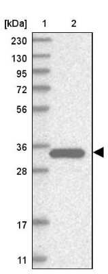 Western Blot: Cytosolic Sulfotransferase 1E1/SULT1E1 Antibody [NBP1-84786]