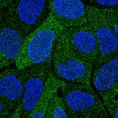 Immunocytochemistry/ Immunofluorescence: Cytosolic Sulfotransferase 2A1/SULT2A1 Antibody [NBP2-32604]