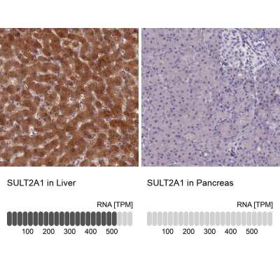 Immunohistochemistry-Paraffin: Cytosolic Sulfotransferase 2A1/SULT2A1 Antibody [NBP2-32604]