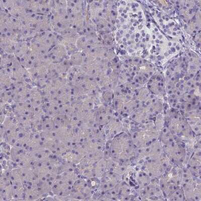 Immunohistochemistry-Paraffin: Cytosolic Sulfotransferase 2A1/SULT2A1 Antibody [NBP2-32604]