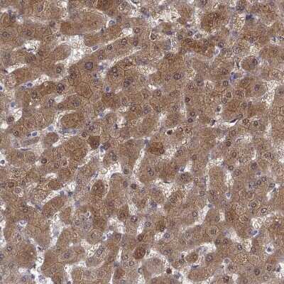 Immunohistochemistry-Paraffin: Cytosolic Sulfotransferase 2A1/SULT2A1 Antibody [NBP2-49402]