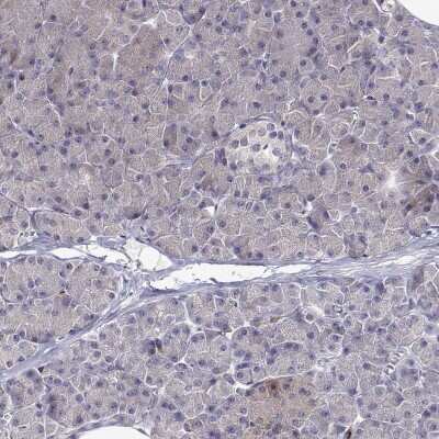 Immunohistochemistry-Paraffin: Cytosolic Sulfotransferase 2A1/SULT2A1 Antibody [NBP2-49402]