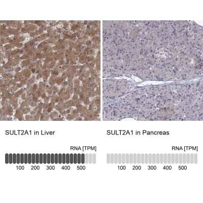 Immunohistochemistry-Paraffin: Cytosolic Sulfotransferase 2A1/SULT2A1 Antibody [NBP2-49402]