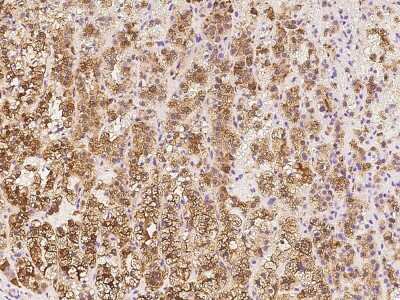 Immunohistochemistry-Paraffin: Cytosolic Sulfotransferase 2A1/SULT2A1 Antibody [NBP2-97722]