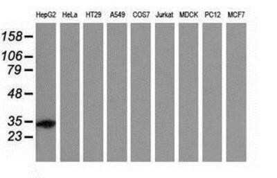 Western Blot: Cytosolic Sulfotransferase 2A1/SULT2A1 Antibody (OTI4D7)Azide and BSA Free [NBP2-71326]