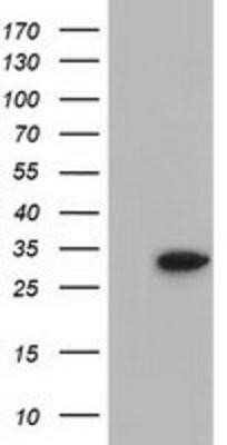 Western Blot: Cytosolic Sulfotransferase 2A1/SULT2A1 Antibody (OTI4D7)Azide and BSA Free [NBP2-71326]