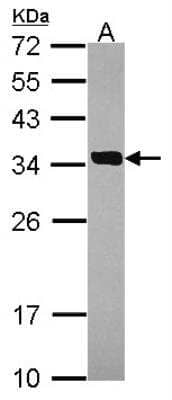 Western Blot: Cytosolic Sulfotransferase 2A1/SULT2A1 Antibody [NBP2-20531]