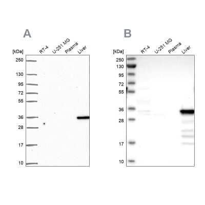 Western Blot: Cytosolic Sulfotransferase 2A1/SULT2A1 Antibody [NBP2-49402]