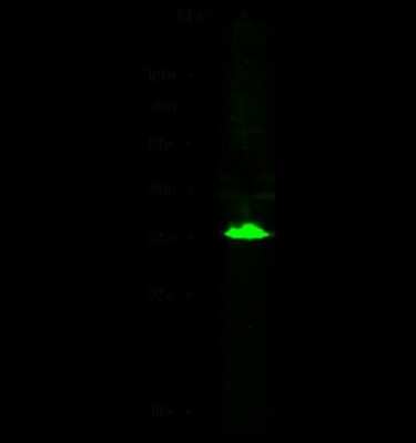 Western Blot: Cytosolic Sulfotransferase 2A1/SULT2A1 Antibody [NBP2-99792]