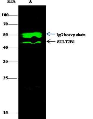 Immunoprecipitation: Cytosolic Sulfotransferase 2B1/SULT2B1 Antibody (007) [NBP2-89895]