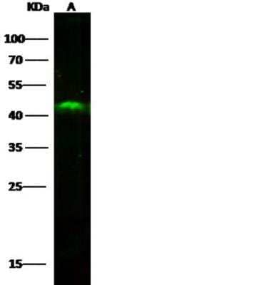 Western Blot: Cytosolic Sulfotransferase 2B1/SULT2B1 Antibody (007) [NBP2-89895]