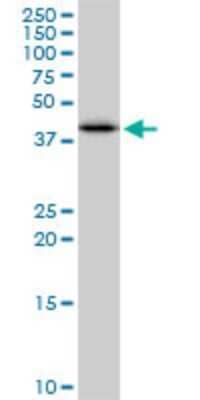 Western Blot: Cytosolic Sulfotransferase 2B1/SULT2B1 Antibody (2E5) [H00006820-M03]