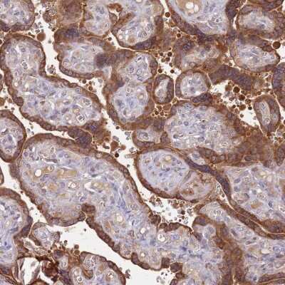 Immunohistochemistry-Paraffin: Cytosolic Sulfotransferase 2B1/SULT2B1 Antibody [NBP2-32596]