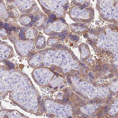 Immunohistochemistry-Paraffin: Cytosolic Sulfotransferase 2B1/SULT2B1 Antibody [NBP2-33396]