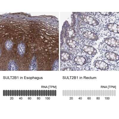 Immunohistochemistry-Paraffin: Cytosolic Sulfotransferase 2B1/SULT2B1 Antibody [NBP3-16997]