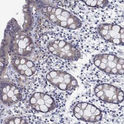 Immunohistochemistry-Paraffin: Cytosolic Sulfotransferase 2B1/SULT2B1 Antibody [NBP3-16997]