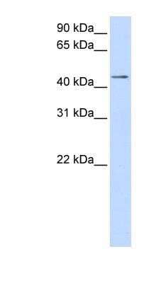 Western Blot: Cytosolic Sulfotransferase 2B1/SULT2B1 Antibody [NBP1-54827]