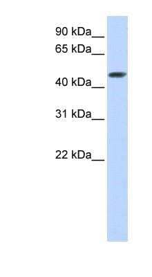 Western Blot: Cytosolic Sulfotransferase 2B1/SULT2B1 Antibody [NBP1-54828]