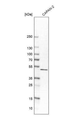 Western Blot: Cytosolic Sulfotransferase 2B1/SULT2B1 Antibody [NBP2-32596]