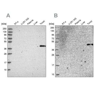 Western Blot: Cytosolic Sulfotransferase 2B1/SULT2B1 Antibody [NBP2-33396]