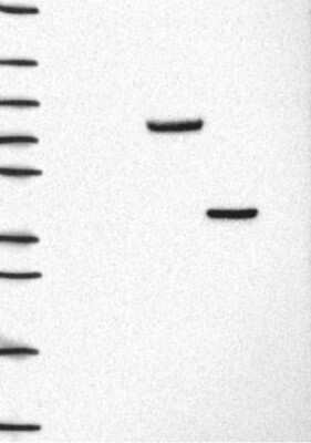 Western Blot: Cytosolic Sulfotransferase 2B1/SULT2B1 Antibody [NBP3-16997]