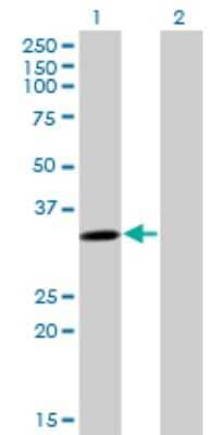 Western Blot: Cytosolic Sulfotransferase 4A1/SULT4A1 Antibody (3C1) [H00025830-M02]