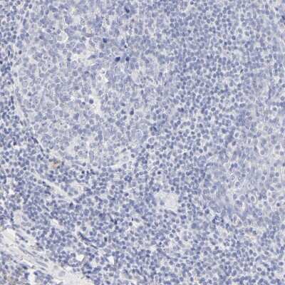 Immunohistochemistry-Paraffin: Cytosolic Sulfotransferase 4A1/SULT4A1 Antibody [NBP1-81770]