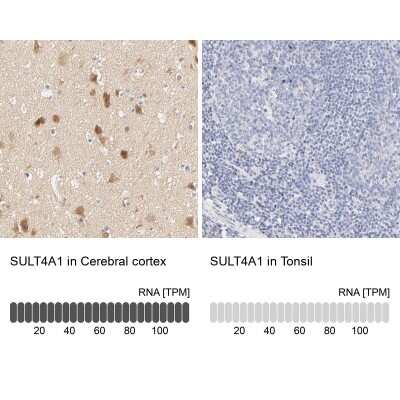 Immunohistochemistry-Paraffin: Cytosolic Sulfotransferase 4A1/SULT4A1 Antibody [NBP1-81770]