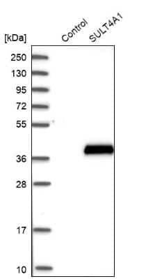 Western Blot: Cytosolic Sulfotransferase 4A1/SULT4A1 Antibody [NBP1-81770]