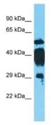 Western Blot: Cytosolic Sulfotransferase 4A1/SULT4A1 Antibody [NBP3-10776]