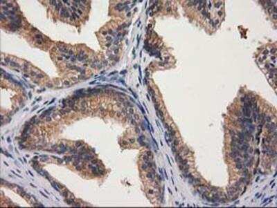 Immunohistochemistry: Cytosolic beta-Glucosidase/GBA3 Antibody (OTI1F1) [NBP2-00521]