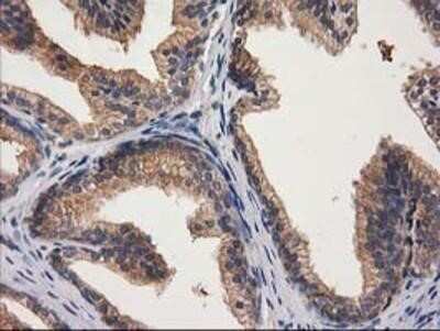 Immunohistochemistry: Cytosolic beta-Glucosidase/GBA3 Antibody (OTI1F1) - Azide and BSA Free [NBP2-72100]