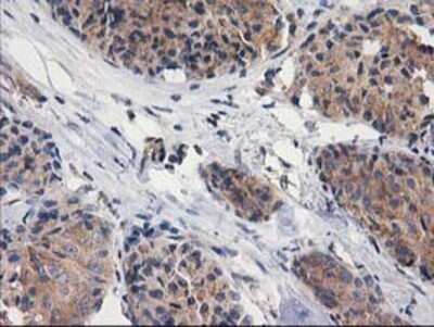 Immunohistochemistry: Cytosolic beta-Glucosidase/GBA3 Antibody (OTI1F1) - Azide and BSA Free [NBP2-72100]
