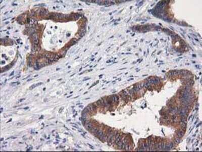 Immunohistochemistry: Cytosolic beta-Glucosidase/GBA3 Antibody (OTI1F1) - Azide and BSA Free [NBP2-72100]