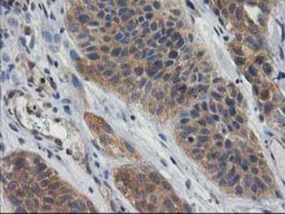 Immunohistochemistry: Cytosolic beta-Glucosidase/GBA3 Antibody (OTI1F1) - Azide and BSA Free [NBP2-72100]