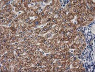 Immunohistochemistry: Cytosolic beta-Glucosidase/GBA3 Antibody (OTI1F1) - Azide and BSA Free [NBP2-72100]