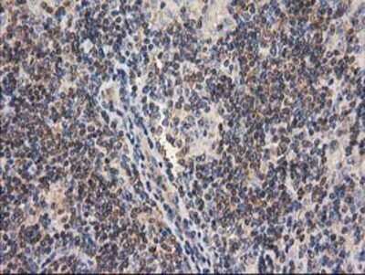 Immunohistochemistry: Cytosolic beta-Glucosidase/GBA3 Antibody (OTI1F1) - Azide and BSA Free [NBP2-72100]