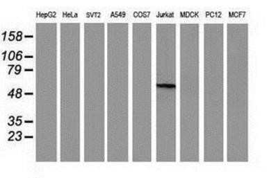 Western Blot: Cytosolic beta-Glucosidase/GBA3 Antibody (OTI1F1)Azide and BSA Free [NBP2-72100]