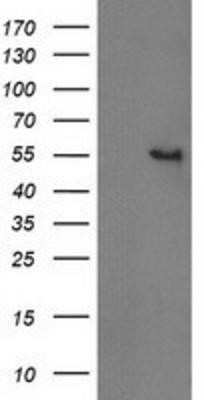 Western Blot: Cytosolic beta-Glucosidase/GBA3 Antibody (OTI1F1)Azide and BSA Free [NBP2-72100]