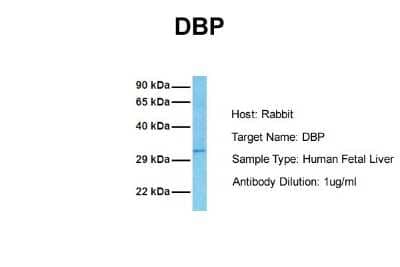 Western Blot: D Box Binding Protein Antibody [NBP2-83996]