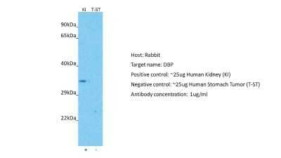 Western Blot: D Box Binding Protein Antibody [NBP2-83997]