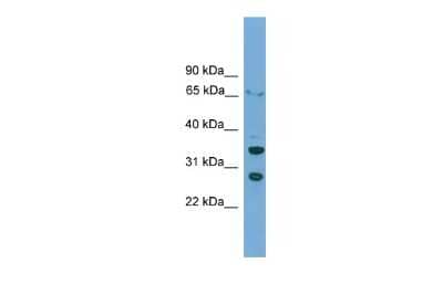 Western Blot: D Box Binding Protein Antibody [NBP2-83998]