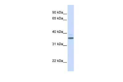 Western Blot: D Box Binding Protein Antibody [NBP2-83999]