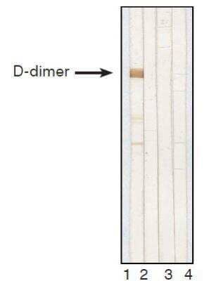 Western Blot: D-Dimer Antibody (DD1) [NB110-8374]