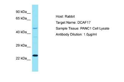 Western Blot: D-Glutamate Cyclase Antibody [NBP2-84782]