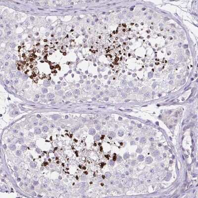 Immunohistochemistry-Paraffin: D2HGDH Antibody [NBP2-31631]