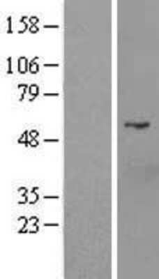 Western Blot: D2HGDH Overexpression Lysate [NBL1-09708]