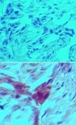 Immunohistochemistry-Paraffin: D4-GDI/RhoGDI2 Antibody (97A1015) - (cleavage specific) - BSA Free [NB100-56725]