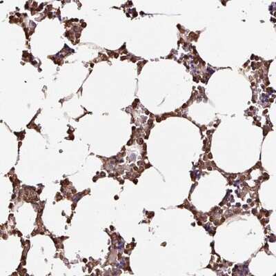 Immunohistochemistry-Paraffin: D4-GDI/RhoGDI2 Antibody [NBP2-33608]