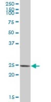 Western Blot: D4-GDI/RhoGDI2 Antibody [H00000397-B01P]